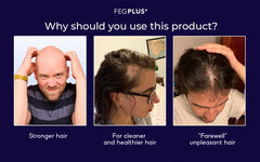 FEG Organic Hair Growth Treatment Oil - MS - uaeFEG Organic Hair Growth Treatment Oil