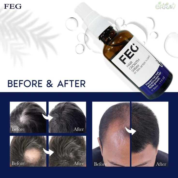 FEG Organic Hair Growth Treatment Oil - MS - uaeFEG Organic Hair Growth Treatment Oil