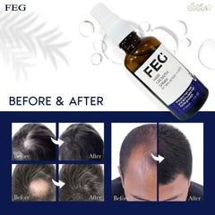 FEG Organic Hair Growth Treatment Oil - MS - uaeFEG Organic Hair Growth Treatment Oil